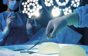 Linfoma anaplásico de células grandes asociado a implantes mamarios diagnosticado mediante punción por aguja fina. Caso clínico