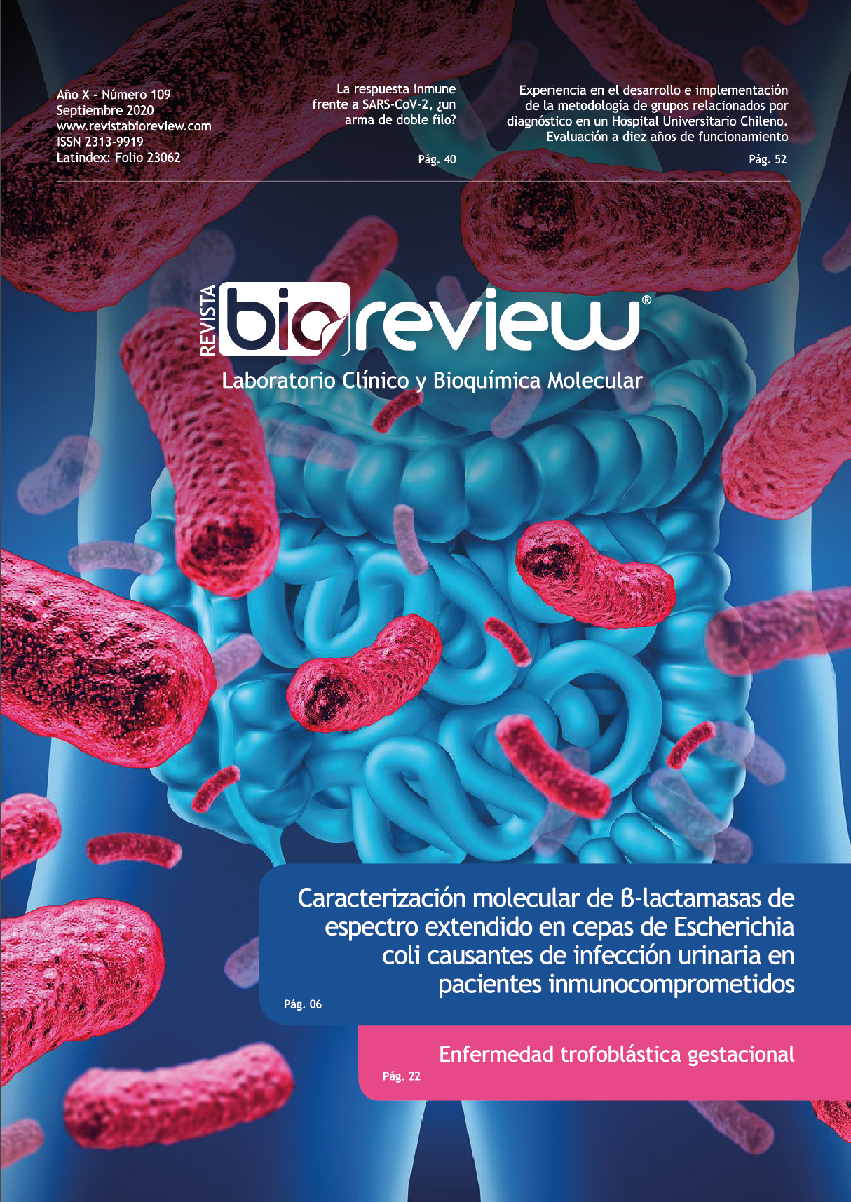 Caracterización molecular de Beta-lactamasas de espectro extendido en cepas de Escherichia coli causantes de infección urinaria en pacientes inmunocomprometidos.