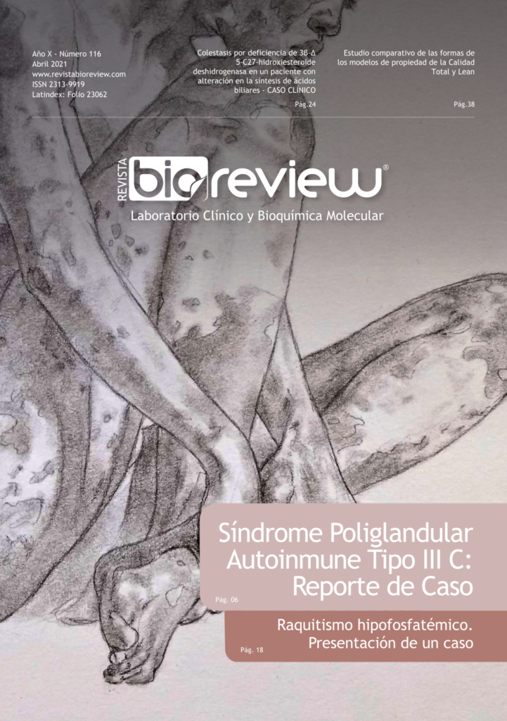 Síndrome Poliglandular Autoinmune Tipo III C