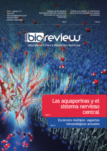 Las aquaporinas y el sistema nervioso central