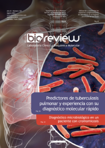 Predictores de tuberculosis pulmonar y experiencia con su diagnóstico molecular rápido