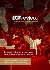 Inmunodeficiencias primarias por déficit de anticuerpos en adultos