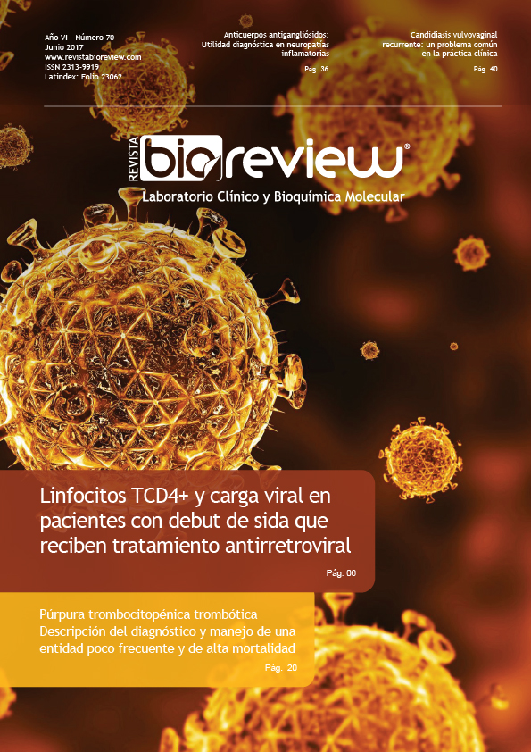 Linfocitos TCD4+ y carga viral en pacientes con debut de SIDA que reciben tratamiento antirretroviral