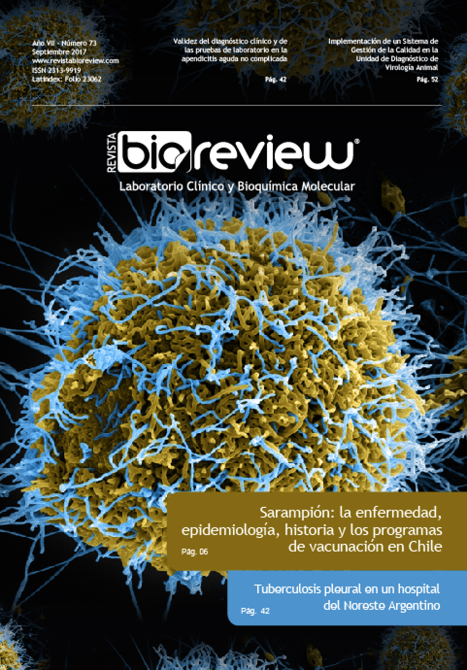 Sarampión: la enfermedad, epidemiología, historia y los programas de vacunación en Chile