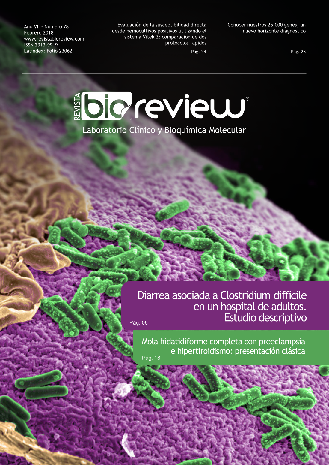 Diarrea asociada a Clostridium difficile en un hospital de adultos. Estudio descriptivo