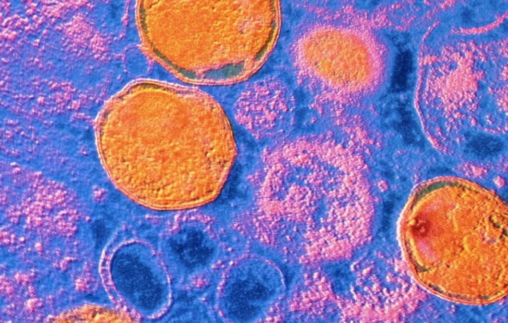 Susceptibilidad antimicrobiana en muestras urogenitales de Ureaplasma urealyticum, el principal agente en infección intramaniótica