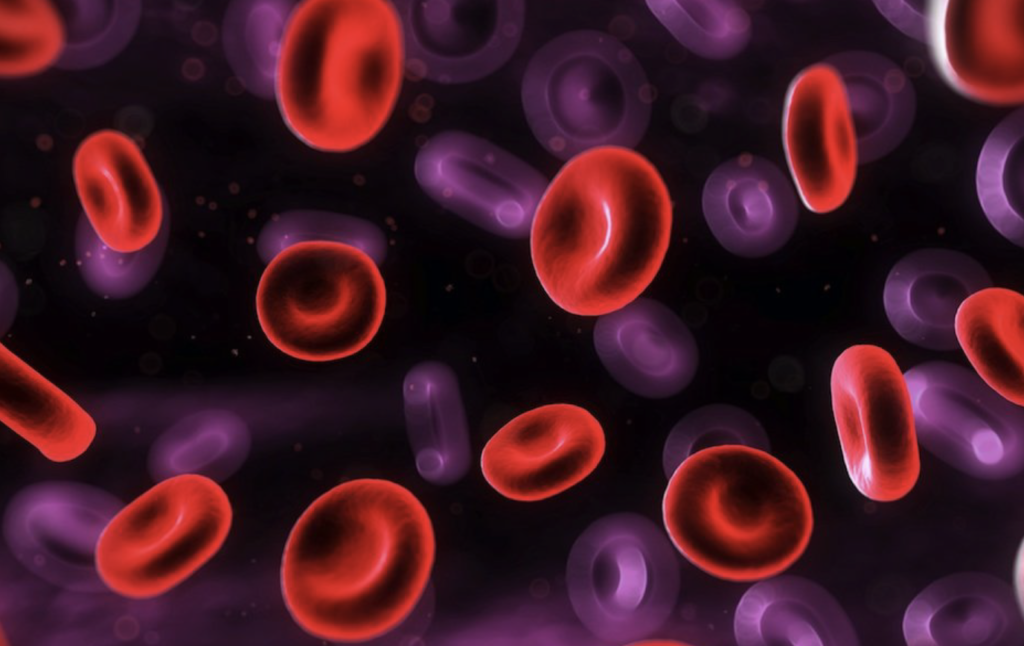 Técnicas de citogenética y biología molecular para el diagnóstico y seguimiento de la leucemia promielocítica