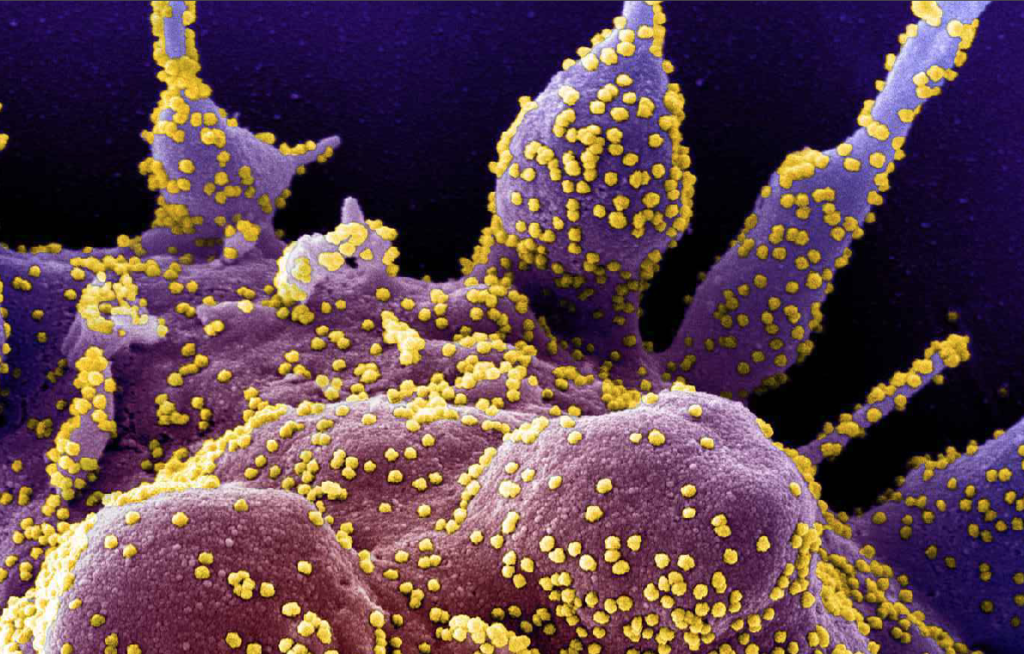 Cargas virales en pacientes trasplantados y genotipificación de Citomegalovirus