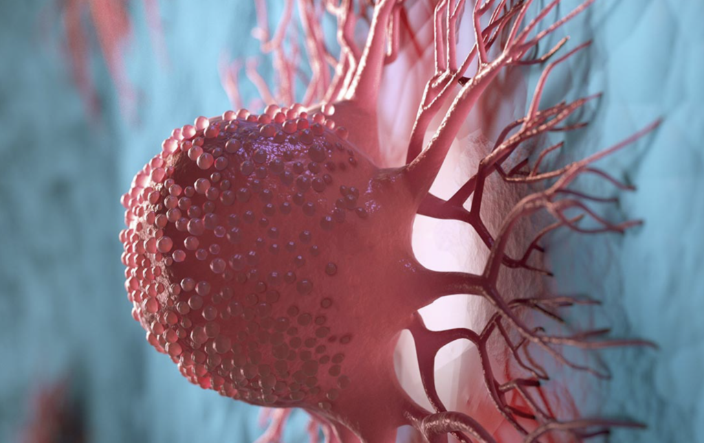ICMT como potencial biomarcador en el cáncer