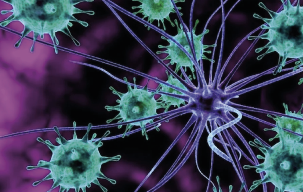 Síndrome de hiperinmunoglobulinemia E