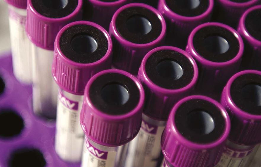Hemoglobina Reticulocitaria en Screening de Ferropenia