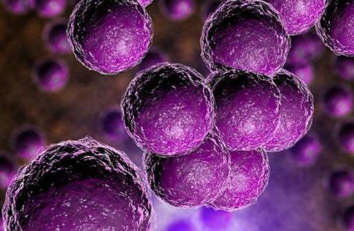 Evaluación de una técnica de PCR en tiempo real para determinar colonización por Streptococcus agalactiae en mujeres gestantes de Medellín que consultan en Dinámica IPS