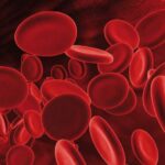 Diagnóstico de neoplasias hematológicas a partir del hemograma y la citomorfología: Casos Clínicos