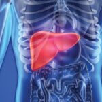 Pruebas de laboratorio en el síndrome de Gilbert consecutivo a hepatitis