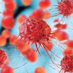 Síndrome de Lynch: selección de pacientes para el estudio genético mediante análisis de inestabilidad microsatelital e inmunohistoquímica