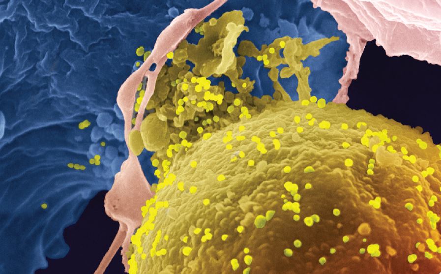 Transmisión parenteral del Virus Linfotrópico T Humano Tipo 1: ¿es un factor de riesgo a considerar para el desarrollo de la leucemia a Células T del adulto?
