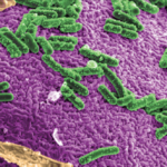 Diarrea asociada a Clostridium difficile en un hospital de adultos. Estudio descriptivo