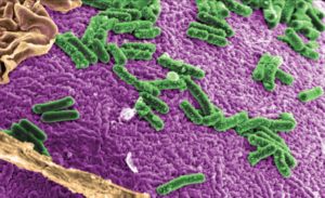 Diarrea asociada a Clostridium difficile en un hospital de adultos. Estudio descriptivo