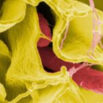 Características clínicas y mortalidad de pacientes adultos con síndrome hemafagocítico, estudio de cohorte retrospectiva