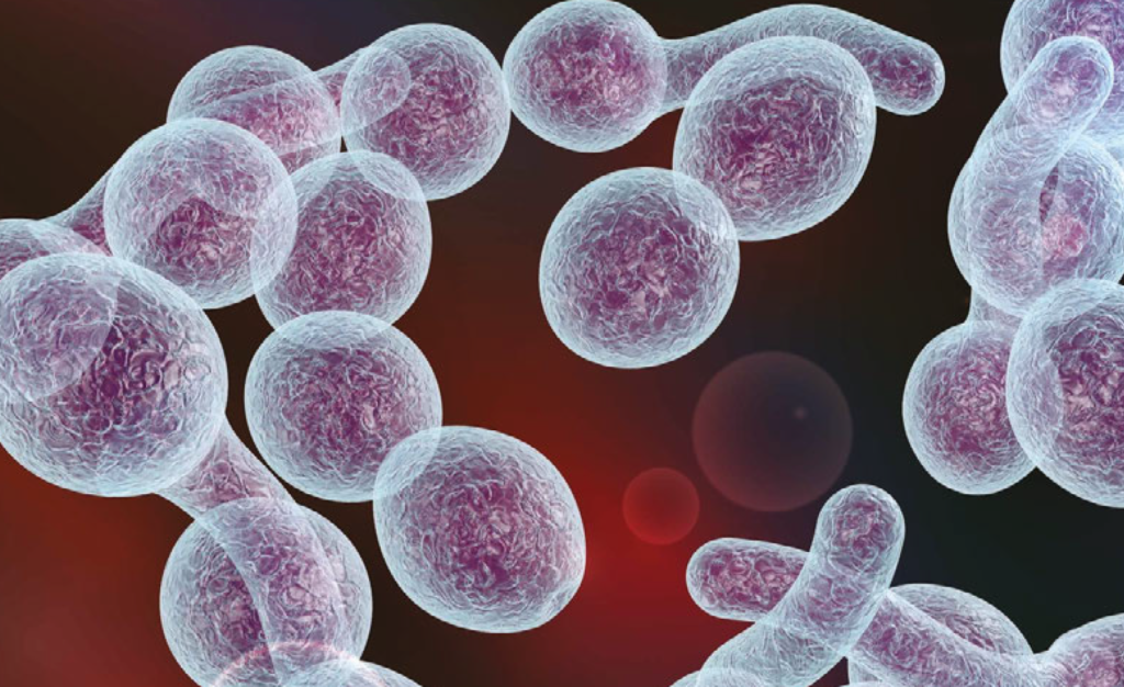 Efectividad del sistema de puntuación de Nugent en el diagnóstico de vaginosis bacteriana