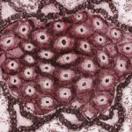 Frecuencia de las mutaciones más comunes del gen CFTR en pacientes peruanos con fibrosis quística mediante la técnica ARMS-PCR