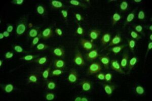 Inmunofluorescencia indirecta versus reacción de polimerasa en cadena para el diagnóstico de virus respiratorios en niños ingresados en un hospital de la Región Metropolitana
