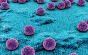 Bacteriemias por Staphylococcus aureus: Factores de Riesgo Asociados a la Resistencia a Meticilina