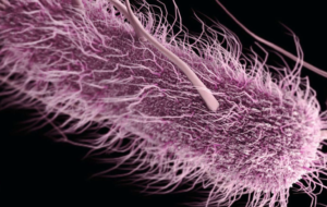 Urocultivo y parcial de orina en el diagnóstico de las infecciones del tracto urinario