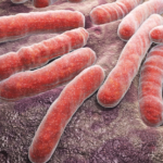 Hallazgos de baciloscopías, genexpert MTB/RIF y cultivos en pacientes con tuberculosis drogoresistente. Hospital Pablo Arturo Suárez