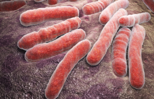 Hallazgos de baciloscopías, genexpert MTB/RIF y cultivos en pacientes con tuberculosis drogoresistente. Hospital Pablo Arturo Suárez