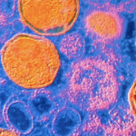Susceptibilidad antimicrobiana en muestras urogenitales de Ureaplasma urealyticum, el principal agente en infección intramaniótica