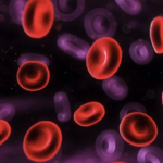 Técnicas de citogenética y biología molecular para el diagnóstico y seguimiento de la leucemia promielocítica