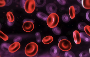 Técnicas de citogenética y biología molecular para el diagnóstico y seguimiento de la leucemia promielocítica