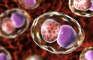 El diagnóstico de Infecciones de Transmisión Sexual por la técnica de biología molecular es la mejor estrategia para su diagnóstico oportuno y específico. Un caso clínico