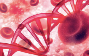 Presentación de caso atípico de leucemia mieloide aguda con coexistencia de NPM1-A e inversión del cromosoma 16