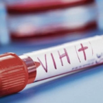 Seropositividad de VIH y factores asociados en donantes de un Banco de Sangre de La Ciudad de Medellín - Colombia, 2005 – 2018