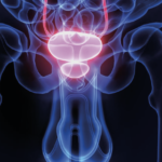 Una mirada global y actualizada del cáncer de próstata