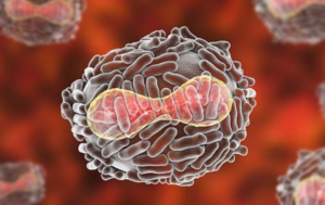 Un paciente con Rickettsiosis variceliforme o viruela rickettsiósica