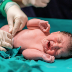 Atención al neonato expuesto o infectado con el virus varicela-zoster