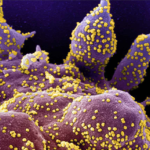 Cargas virales en pacientes trasplantados y genotipificación de Citomegalovirus