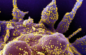 Cargas virales en pacientes trasplantados y genotipificación de Citomegalovirus