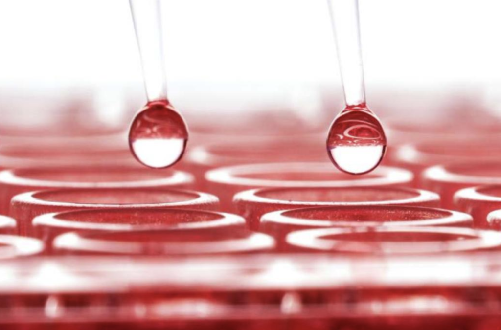 Comparación entre el diagnóstico serológico y el diagnóstico por reacción en cadena de la polimerasa (PCR) para Escherichia Coli enteropatogénica (EPEC)