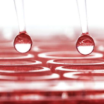 Comparación entre el diagnóstico serológico y el diagnóstico por reacción en cadena de la polimerasa (PCR) para Escherichia Coli enteropatogénica (EPEC)