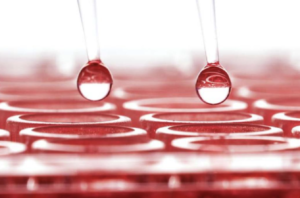 Comparación entre el diagnóstico serológico y el diagnóstico por reacción en cadena de la polimerasa (PCR) para Escherichia Coli enteropatogénica (EPEC)