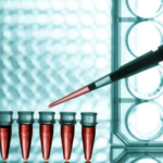 Predisposición genética para el cáncer de mama: genes BRCA1 y BRCA2