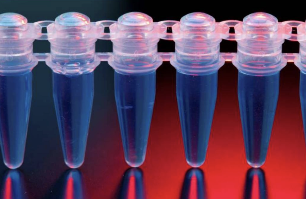 Fisiopatología, diagnóstico y tratamiento de la enfermedad de Whipple