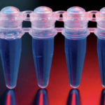 Fisiopatología, diagnóstico y tratamiento de la enfermedad de Whipple