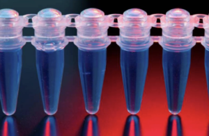 Fisiopatología, diagnóstico y tratamiento de la enfermedad de Whipple
