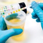 La microalbuminuria como factor pronóstico en un grupo de pacientes hipertensos de una entidad de primer nivel