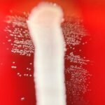 Granulicatella spp